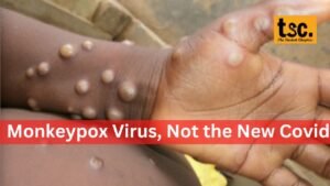 monkeypox virus